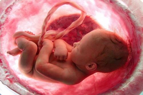 سقط جنین با افزایش ریسك مرگ زودهنگام مرتبط می باشد