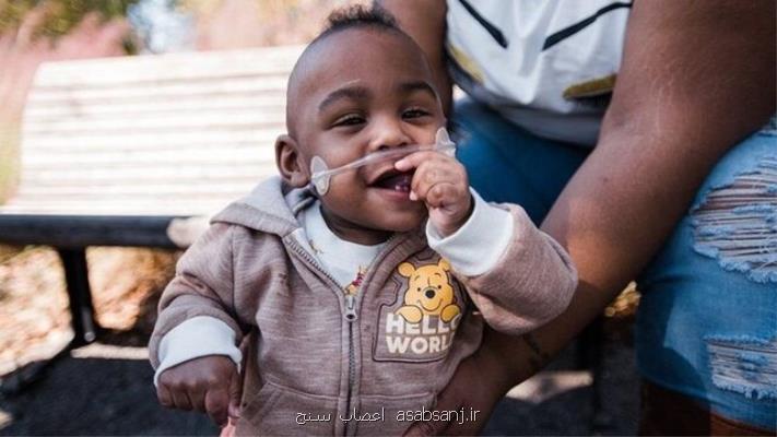 رکوردزنی نارس ترین نوزاد جهان در زنده ماندن