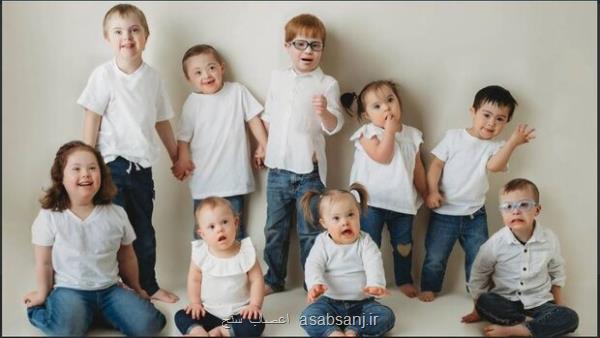 مبتلایان سندرم داون در معرض خطر بیشتر سکته مغزی و حمله قلبی