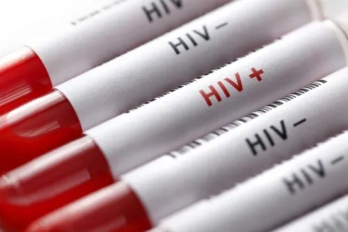 آغاز پویش من هم تست HIV می دهم از امروز تا 20 آذرماه