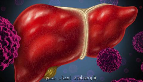 صدمه های كبدی مصرف الكل را بشناسید