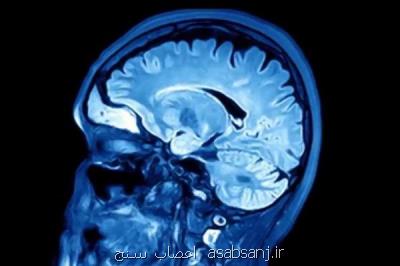صدمه مغزی عامل زوال عقل در بعضی میانسالان