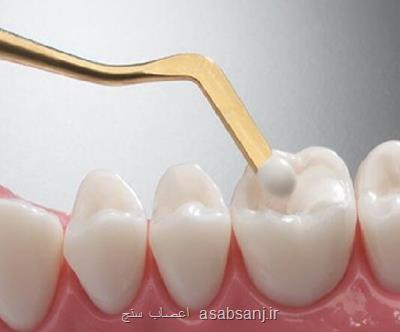 تولید نانوكامپوزیت های دندان نژاد ایرانی در كشور